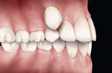 ortodontie 8